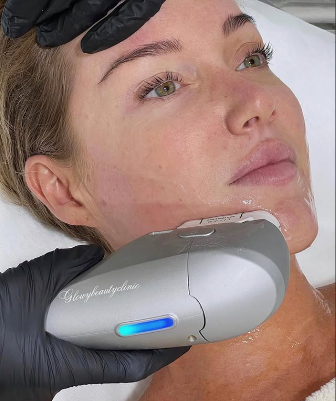 HIFU behandling — Glowy Beauty Clinic