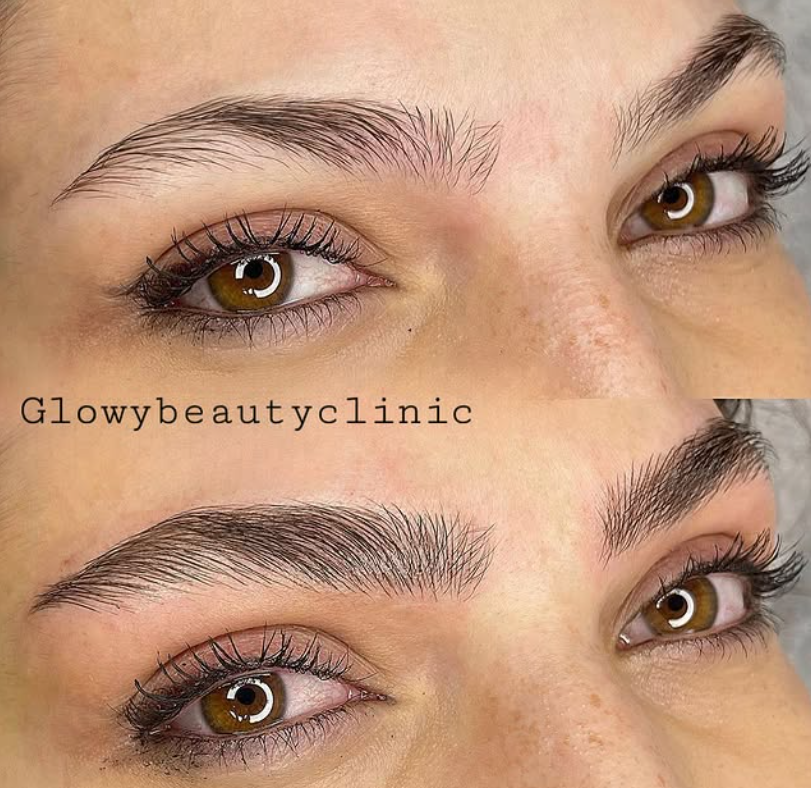 Microblading före och efter — Glowy Beauty Clinic