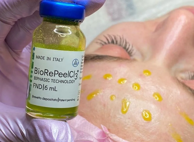 Kemisk Peeling — Biorepeel