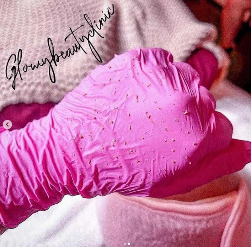 Ansiktsbehandling med peelingmask — Glowy Beauty Clinic